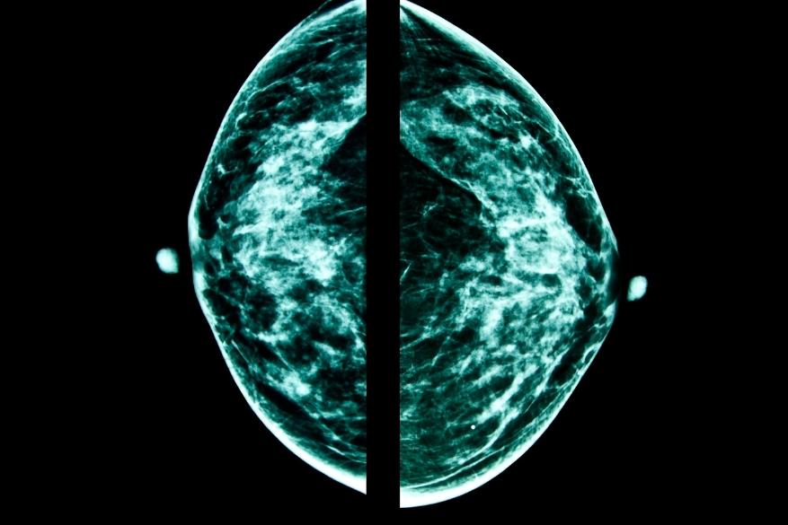 Μεγεθυντική Μεγεθυντική