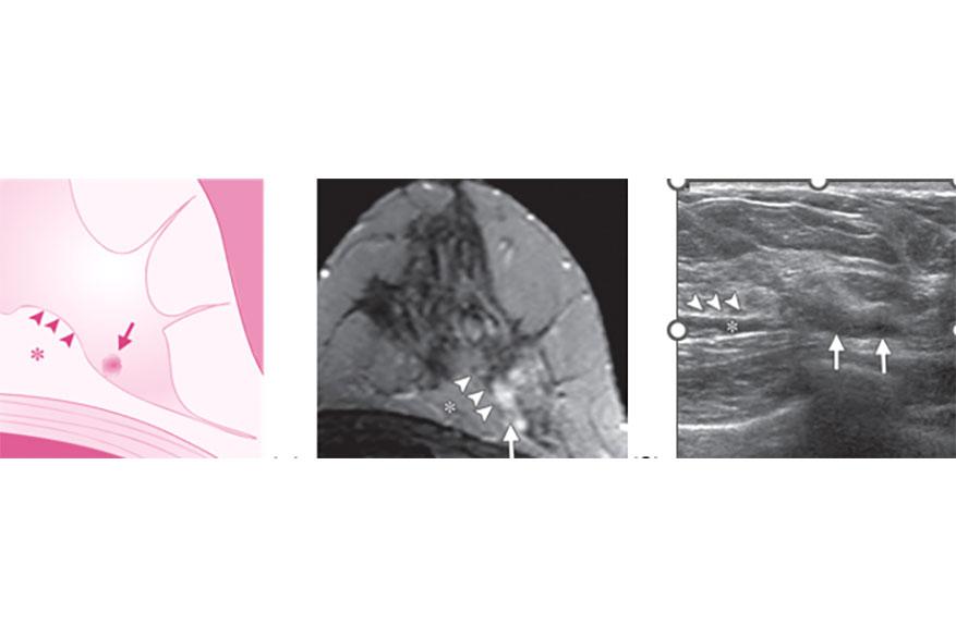 Second look υπερηχογράφημα