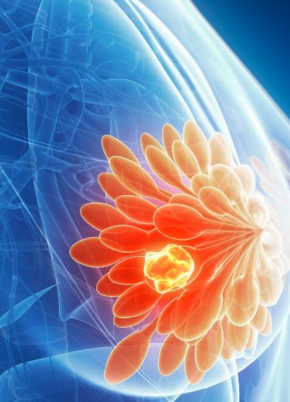 Επεμβατικές πράξεις σε παθήσεις μαστών